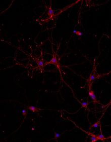 This photo by Ezgi Hacisuleyman, Ph.D., shows localization of a TurbolD enzyme in dendrites in red. Blue is the nucleus. 